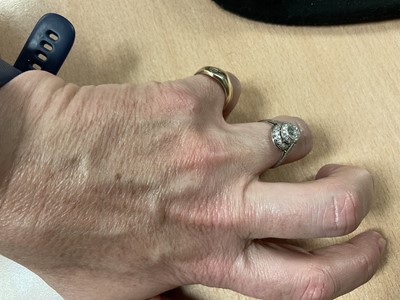 Lot 760 - Art Deco diamond single stone ring